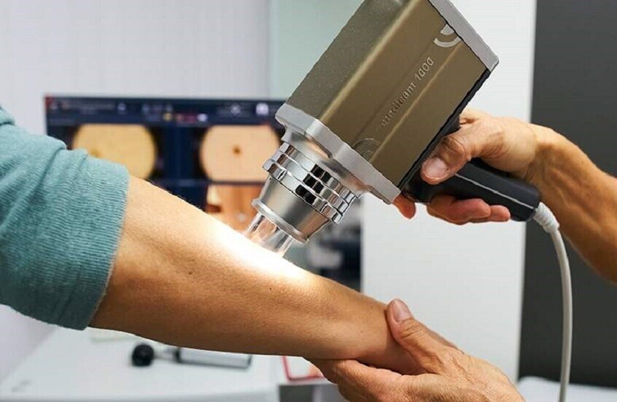 عوامل خطر سرطان پوست