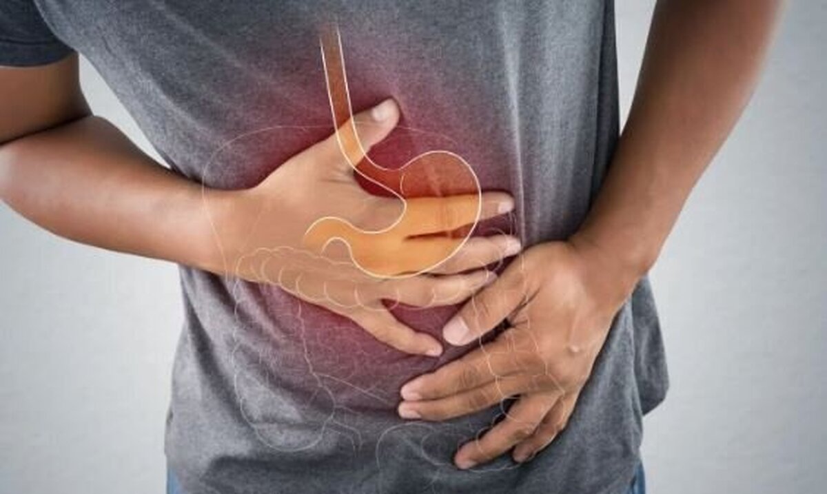 چگونه از جراحی اسلیو معده بهترین نتیجه را بگیریم؟
