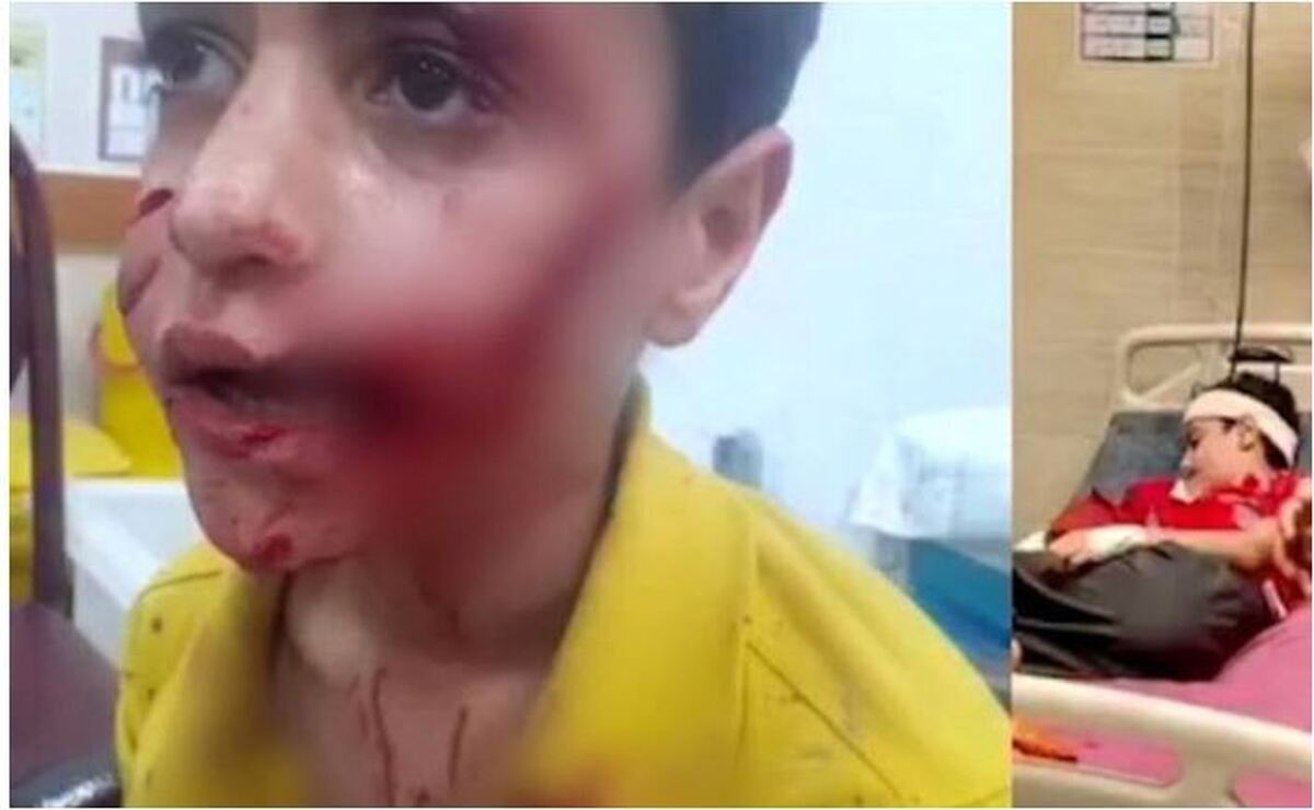فوت کودک ۱۱ ساله در اثر حمله سگ‌های ولگرد در این شهر