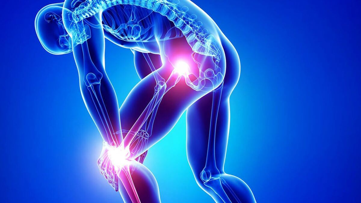 چه دلایلی منجر به بروز آرتروز میشود؟
