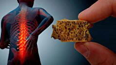 با این ورزش ریسک شکستگی استخوان را در سنین بالا کاهش دهید