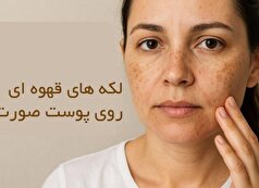 از مشکلات شایع پوستی اینگونه پیشگیری کنید!