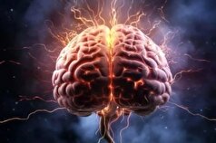 چگونه می‌شود عوارض سکته مغزی را در بیمار کاهش داد؟