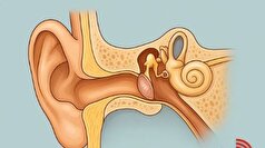چه عواملی باعث آسیب به پرده گوش می‌شود؟ چگونه از آن جلوگیری کنیم؟