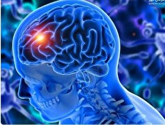 گلیوبلاستوما بیماری خطرناکی که باید با آن آشنا شوید+علائم