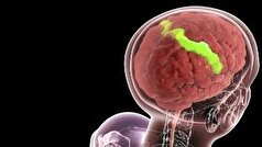 با افزایش سن مغز چه تغییراتی میکند؟