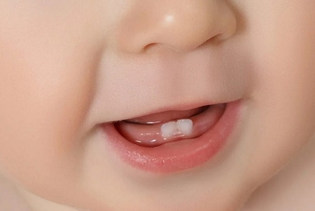 زمان و ترتیب رویش دندان‌ها در نوزاد به چه صورت است؟
