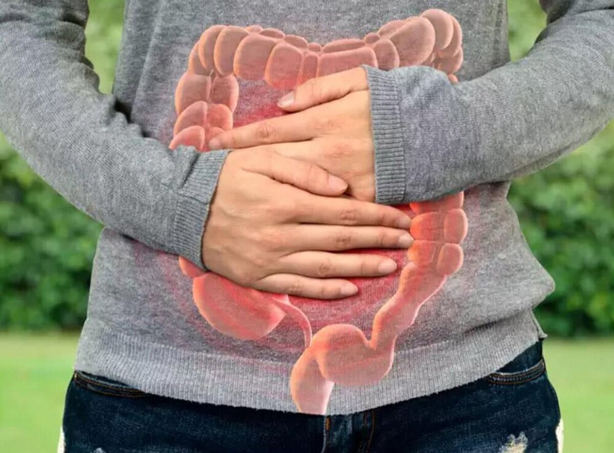 برای پیشگیری از این سرطان از ۵۰ سالگی غربالگری منظم را شروع کنید!