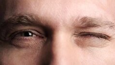 تغذیه مناسب برای سلامت چشم‌ها چگونه است؟