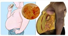نگاهی به اصلی‌ترین دلیل بی اختیاری ادرار در زنان