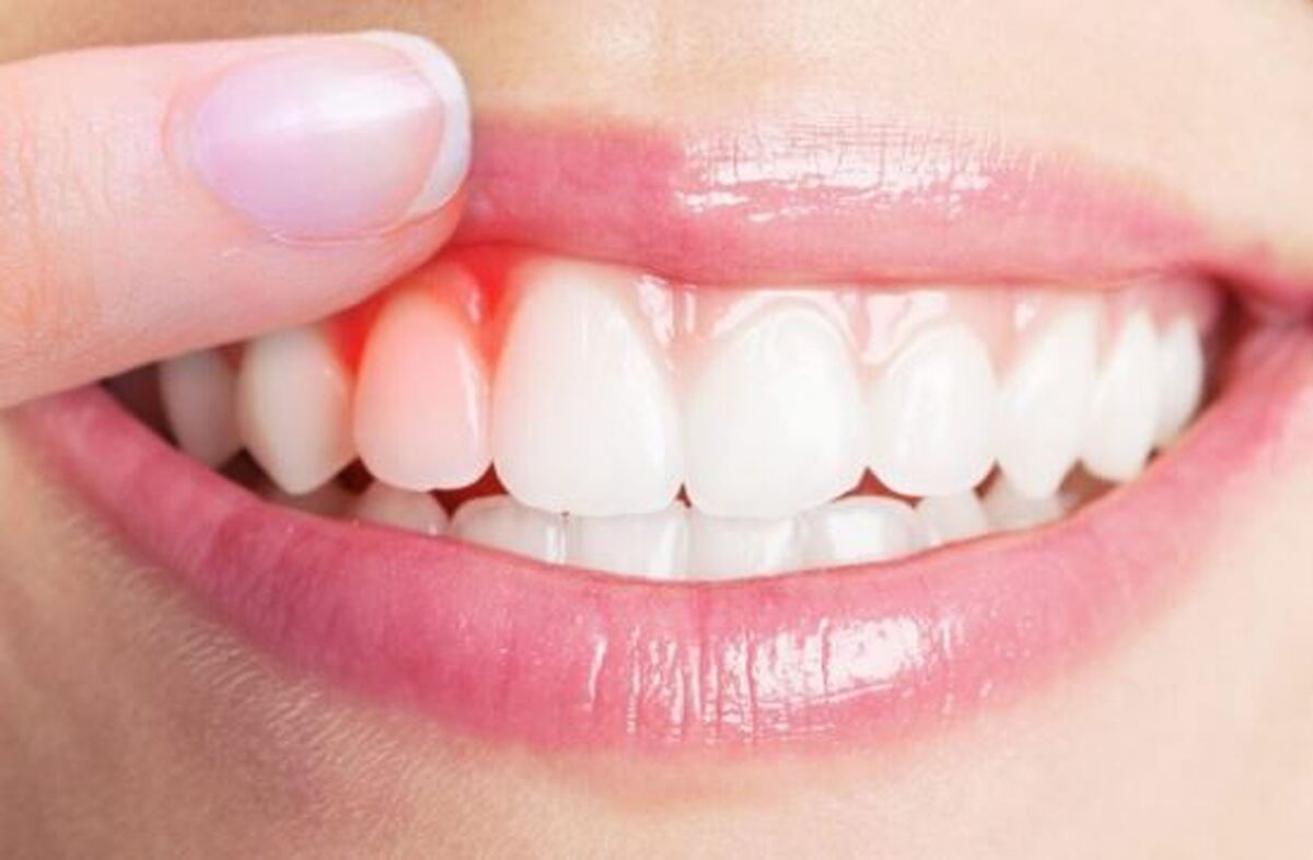 چرا بعضی‌ها با وجود مسواک زدن دندان‌های زردی دارند؟