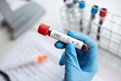 دانشمندان پروتئینی را کشف کرده‌اند که ویروس HIV «خفته» را در بدن انسان از بین می‌برد