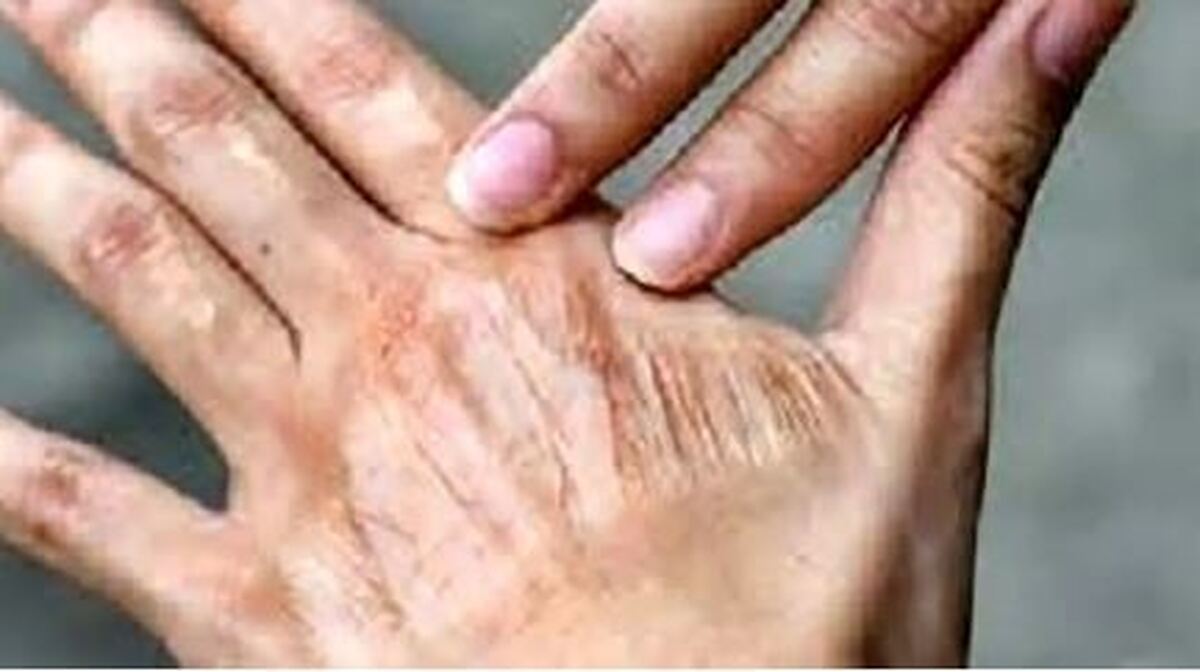 اشتباهات رایج در روتین‌های پوستی که نباید انجام دهید