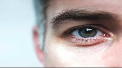 کم‌خوابی، تهدید جدی برای سلامت چشم‌ها