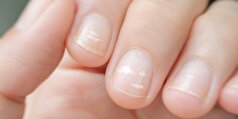 JAMA Dermatology: تغییرات ناخن ممکن است نشان دهنده خطر سرطان باشد