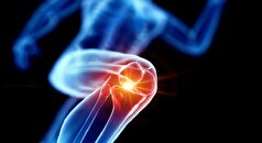 میکروپلاستیک‌ها بر مستحکم شدن ساختار استخوان‌ها چه تاثیری دارد؟