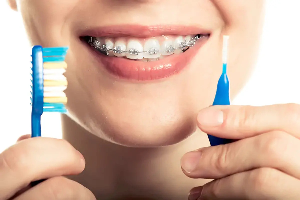 بیماران ارتودنسی درگیر چه مشکلاتی میشوند؟ راهکار چیست؟