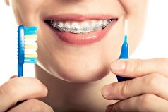 بیماران ارتودنسی درگیر چه مشکلاتی میشوند؟ راهکار چیست؟