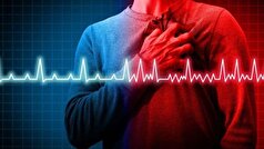 عمل سوزاندن رگ قلبی با کمک اسکنر آم‌آرآی با موفقیت انجام شد!