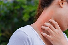 Scientific Reports: جیوه باعث آلرژی در کودکان می‌شود