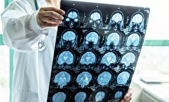 روند سالم زندگی کردن میتوانند پیری مغز را به تأخیر بیاندازند