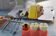 تاثیر مخرب سیگار‌های الکترونیکی بر سلامت دهان و دندان