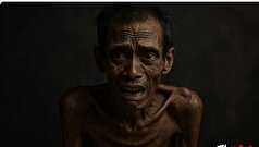 کورو یک بیماری عجیب و اسرار آمیز که مغز شما را هدف می‌گیرد