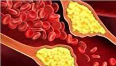 روغن زیتون چگونه باعث جلوگیری از سکته‌های قلبی و مغزی می‌شود؟