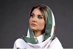چهره گلوریا هاردی زیر و رو شد! +عکس