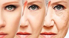 با مصرف این میوه پوستی صاف و شاداب داشته باشید