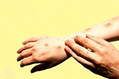 تب دِنگی در استان هرمزگان به مرز خطر رسید!