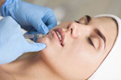 یک متخصص زیبایی توضیح داد که چرا ممکن است بوتاکس دیگر کار نکند