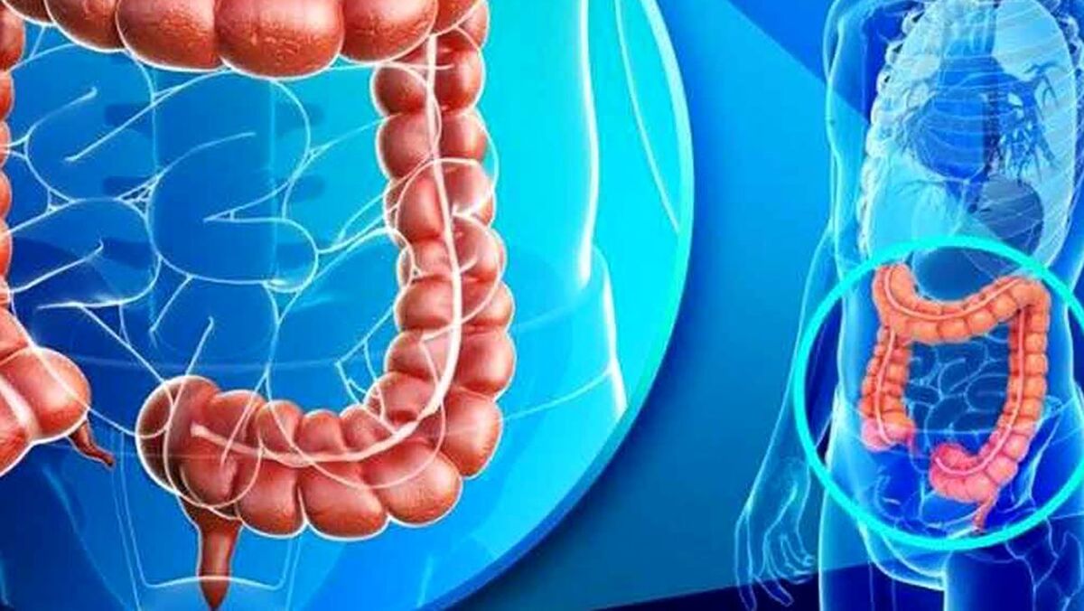 چرا پاکسازی روده ضروری است؟
