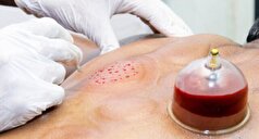 حجامت عام، حجامتی مناسب برای پاییز