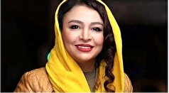 مه‌لقا باقری از چهره جدیدش بعد از عمل‌های زیبایی رونمایی کرد! +عکس