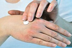 راه رسیدن به پوستی مرطوب و لطیف در پاییز