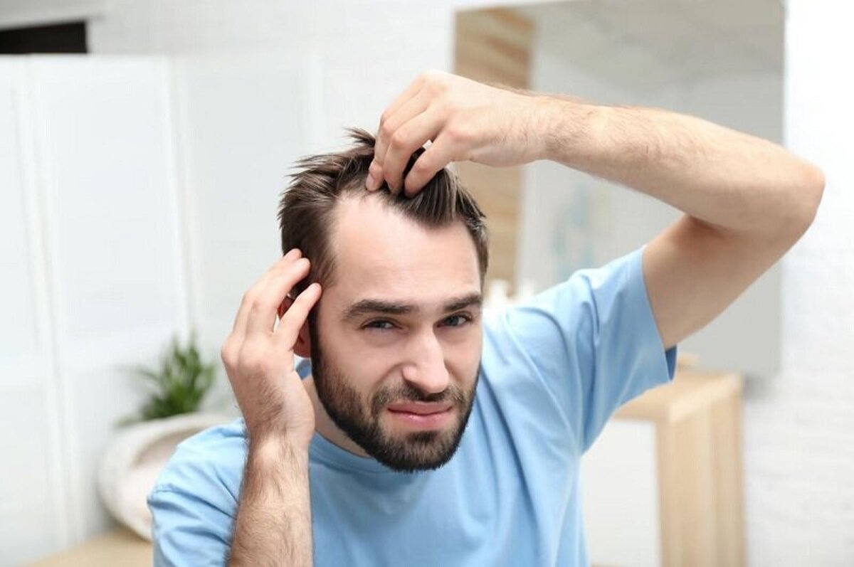 یک داروی درمان ریزش مو که باعث افسردگی می‌شود