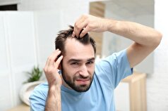 یک داروی درمان ریزش مو که باعث افسردگی می‌شود