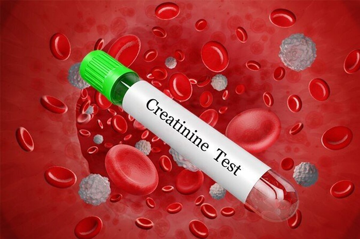 آزمایش کراتین سلامت چه اندامی را در بدن نشان می‌دهد؟