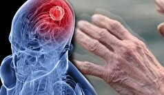 چگونه میتوان مانع پیشروی پارکینسون شد؟