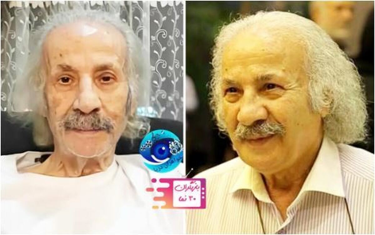 تفاوت چهره سعید پیردوست، قبل و بعد از بستری شدنش در بیمارستان/آقای بازیگر چقدر سختی کشیده..