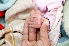 کاهش چشمگیر سوءتغذیه کودکان زیر پنج سال در البرز