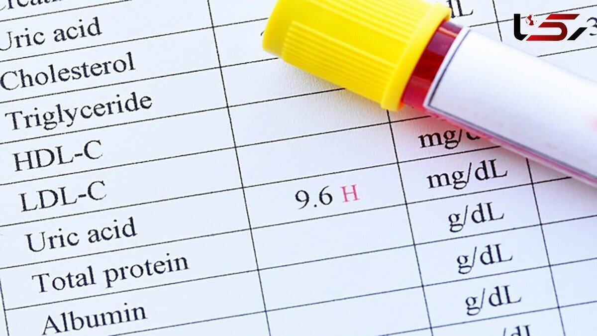 چرا افزایش اوره در خون خطرناک است؟ چگونه آن را کاهش دهیم؟