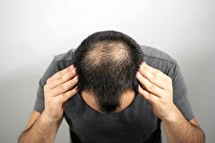 گیاه استویا ریزش مو را کاهش می‌دهد!