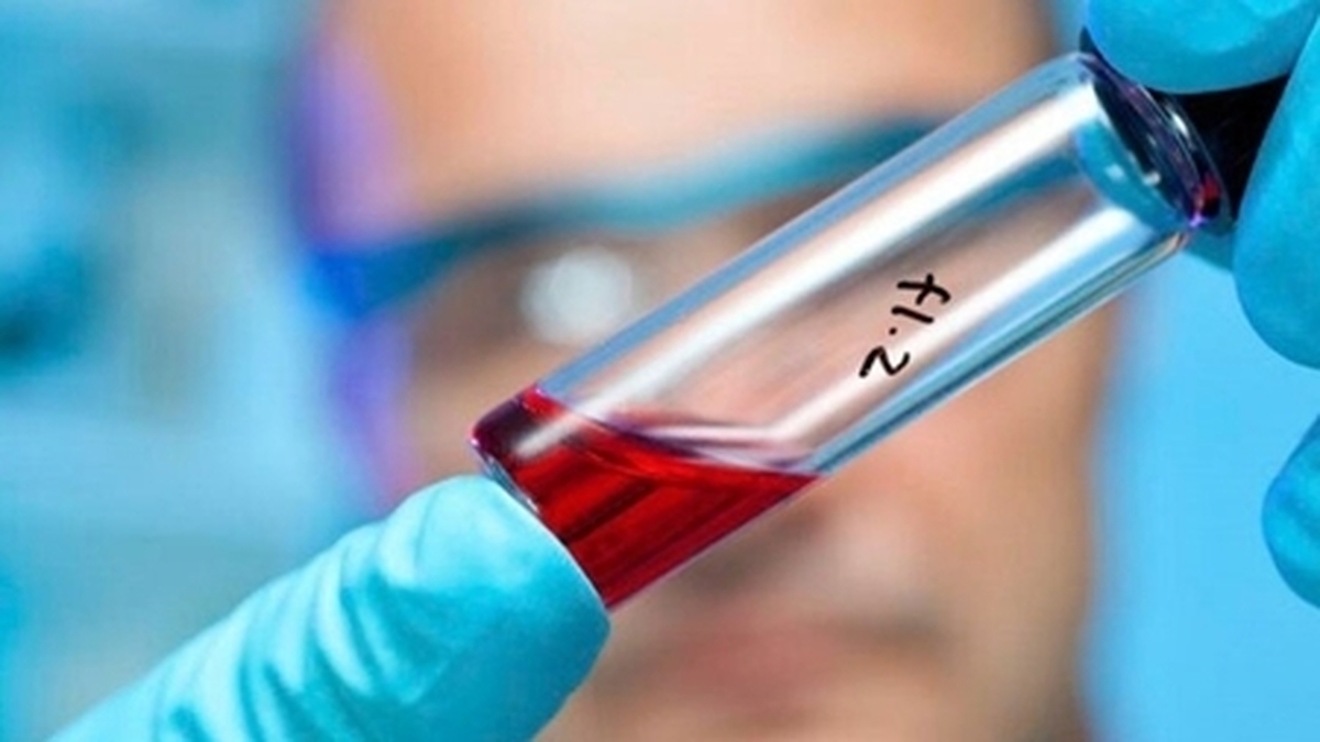 این بیماری باعث تشدید عفونت خونی و مرگ میشود!