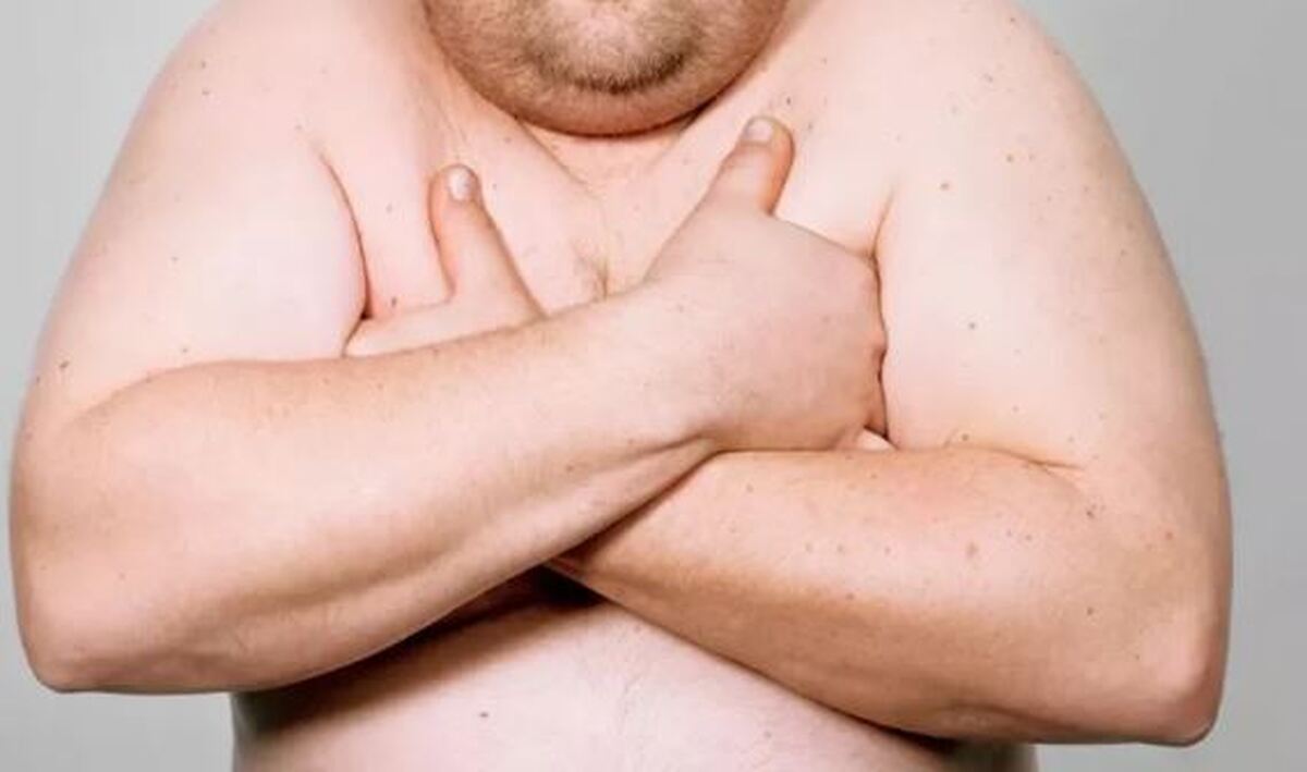 آیا داشتن «پستان‌های مردانه» خطرناک و نشانه بیماری است؟ /چگونه می‌شود از شر آن راحت شد؟