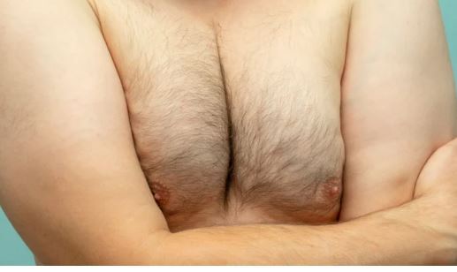 آیا داشتن «پستانهای مردانه» خطرناک و نشانه بیماری است؟ /چگونه میشود از شر آن راحت شد؟ آیا داشتن «پستانهای مردانه» خطرناک و نشانه بیماری است؟ /چگونه میشود از شر آن راحت شد؟