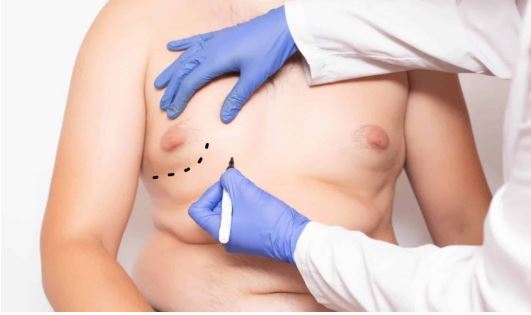 آیا داشتن «پستانهای مردانه» خطرناک و نشانه بیماری است؟ /چگونه میشود از شر آن راحت شد؟ آیا داشتن «پستانهای مردانه» خطرناک و نشانه بیماری است؟ /چگونه میشود از شر آن راحت شد؟