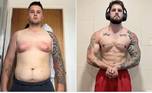 آیا داشتن «پستانهای مردانه» خطرناک و نشانه بیماری است؟ /چگونه میشود از شر آن راحت شد؟ آیا داشتن «پستانهای مردانه» خطرناک و نشانه بیماری است؟ /چگونه میشود از شر آن راحت شد؟