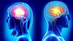 چرا مغز زنان کندتر پیر میشود؟
